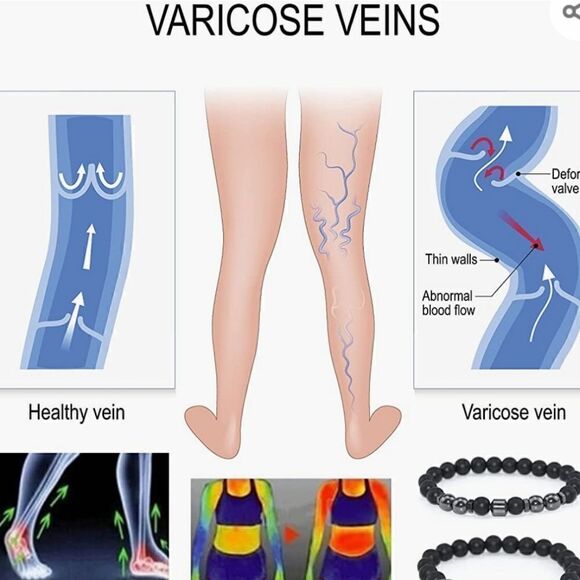 Anti swelling black obsidian stretch stone bracelet. - Picture 8 of 9